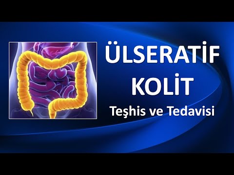 ÜLSERATİF KOLİT NEDİR? NASIL TEDAVİ EDİLİR?