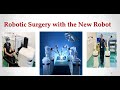 Robotic surgery with cmr versius surgical robotic system  drdeepa ganesh  first in south india