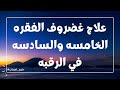 انا عندي ضعط علي الفقرات الخامسه والسادسه العنقيه ايه التمارين اللي ممكن اعملها حكيم اعصاب