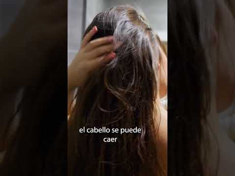 Causas de caida