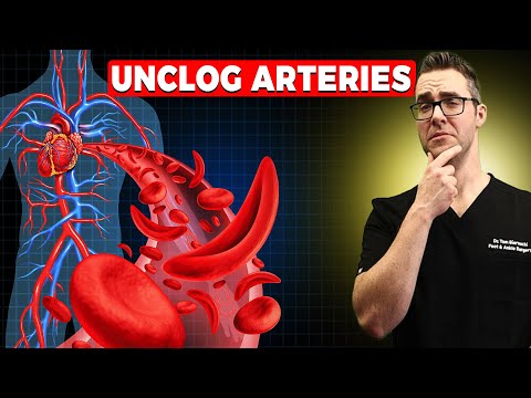 29 WORST Heart & Artery Foods To Avoid [🔄 REVERSE Clogged Arteries!]