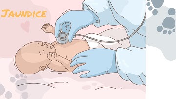 "Jaundice Explained: Causes, Symptoms, and Treatment