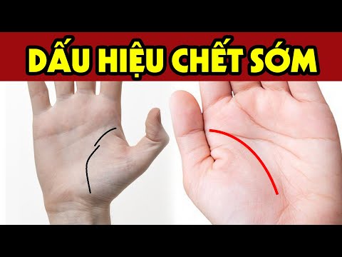 Video: Các đường Trên Bàn Tay Thay đổi Như Thế Nào