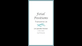 Fetal Positions: Transverse Lie