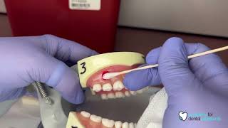 How to Place Topical Anesthetic and Assemble an Anesthetic Syringe