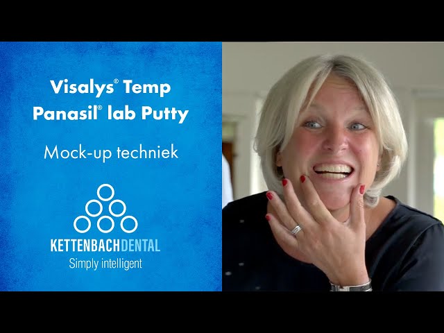 Visalys® Temp Mock-up techniek met Panasil® lab Putty als overdrachtsmal