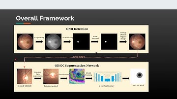 Retinal Segmentation for Glaucoma Diagnosis using Deep Learning