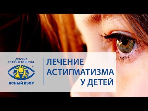 Как лечить астигматизм у детей в домашних условиях