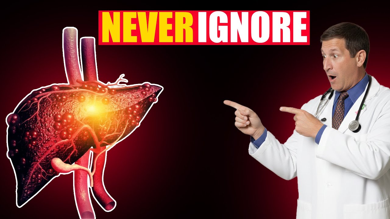 Hepatologist Warns 8 Hidden Risks of Fatty Liver Disease You Don't Know (Don’t Ignore #5)