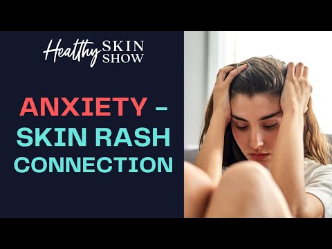 Anxiety & Skin Rash Connection | Dr. Sara DeFrancesco