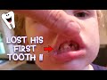 Lost his first tooth!