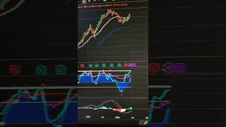 $MSTR HOOD MSFT STOCK ANALYSIS 🚨 JUNE 25