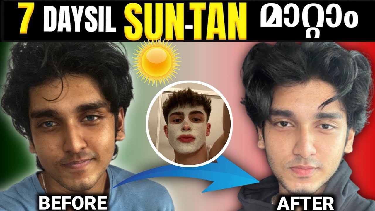 Remove Sun Tan your face naturally (Malayalam)