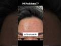 99 Problems Ka One Solution The Ordinary Niacinamide Serum Skincare Skincaretips Serum Selfcare 99 Problems Ka One Solution The Ordinary Niacinamide Serum Skincare Skincaretips Serum Selfcare