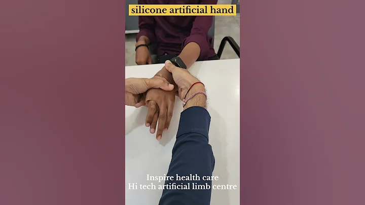 Best quality Silicone Artificial hand 🖐️ at Inspire health care, Hi tech artificial limb centre