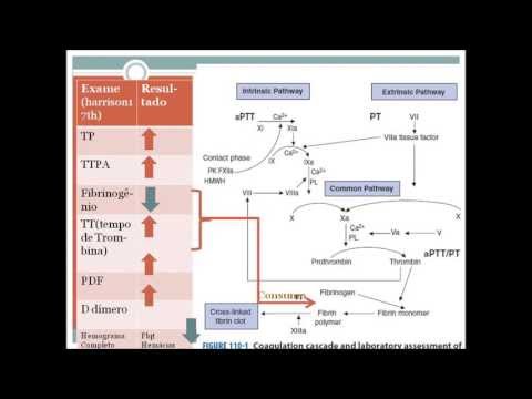 Coagulação Intravascular Disseminada.  CIVD.  EDUARDO FURTADO.  HUAP UFF MEC.