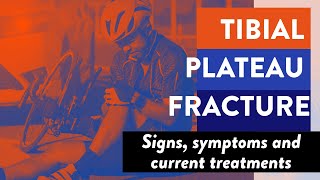 Tibial plateau fracture: Signs, symptoms and current treatments