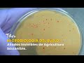 Microbiología del Suelo: Aliados Invisibles de Agricultura Sostenible -TvAgro por Juan Gonzalo Angel