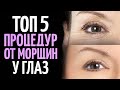 Как избавиться от морщин вокруг глаз? ТОП 5 процедур.