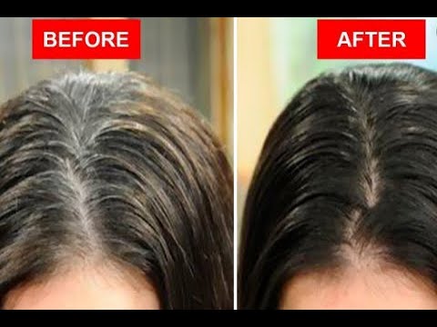 How to turn grey hair to black naturally | Walnut shell for grey hair | Food to reverse grey hair