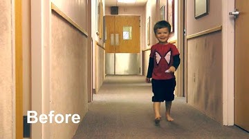 Before and After: low tone pronation | Fast Fit Chipmunk | Cascade Dafo