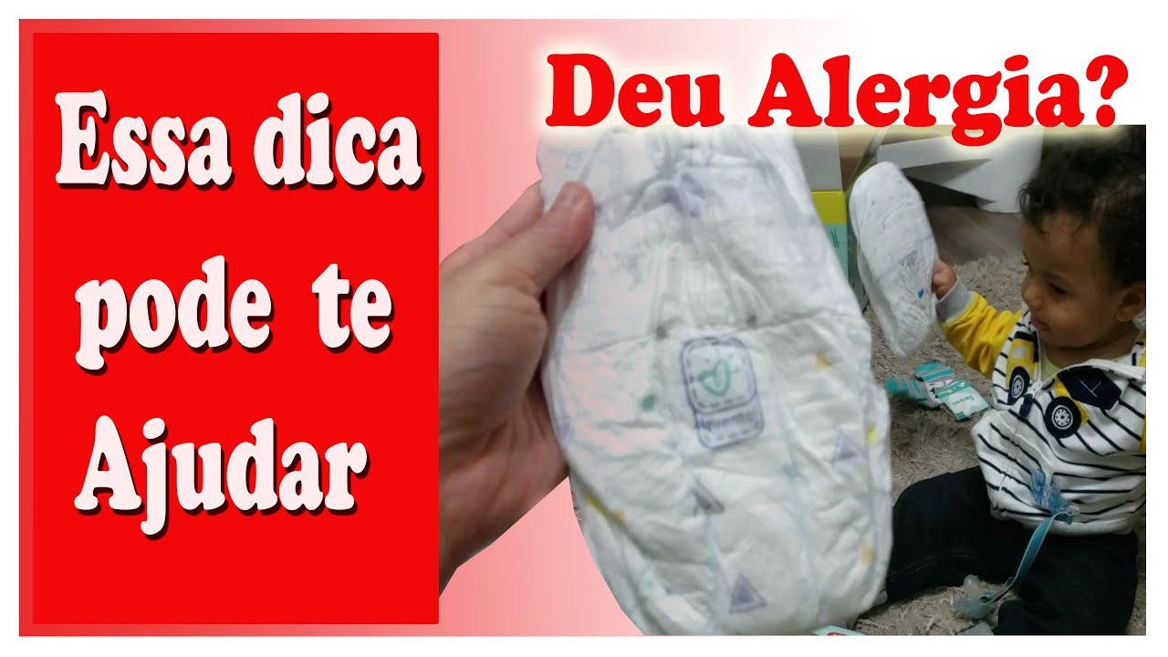 Alergia À Fralda: Como É? Por Que Acontece? Como Tratar? – PFTRST