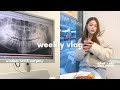 vlog | wisdom teeth removal 🦷 what i eat in a week + surgery recovery 🧇