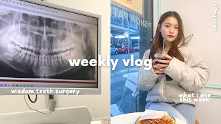 Vlog Wisdom Teeth Removal What I Eat In A Week Surgery Recovery