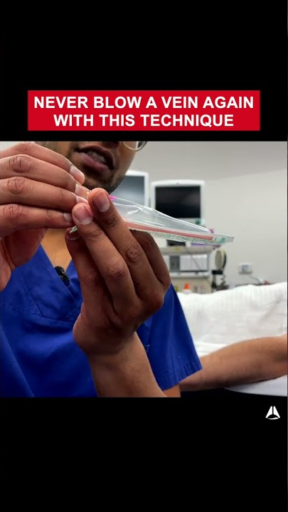 Never Blow a Vein Again With This Technique | #shorts #ivcannulation #anesthesiology #nurse