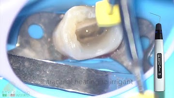 Eighteeth Fast-Pack Clinical Case by Dr.Mohammed Za