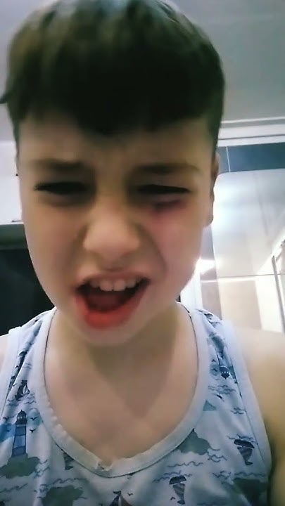 усик драка