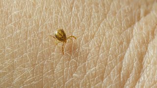 Ticks and Lyme Disease: Signs, symptoms, prevention tips