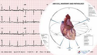 Cardiac Physiology Ecg Leads Interpretation In 10 Minutes