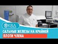 Сальные железы на крайней плоти члена. Клинический случай №136