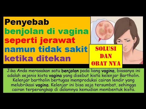 Penyebab Benjolan Di Vagina Seperti Jerawat Namun Tidak Sakit Ketika