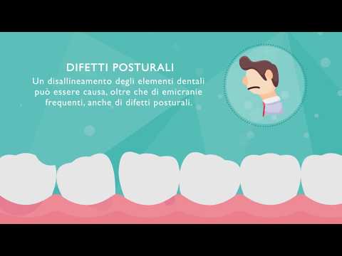 Video: Denti Storti: Cause, Preoccupazioni E Come Raddrizzare