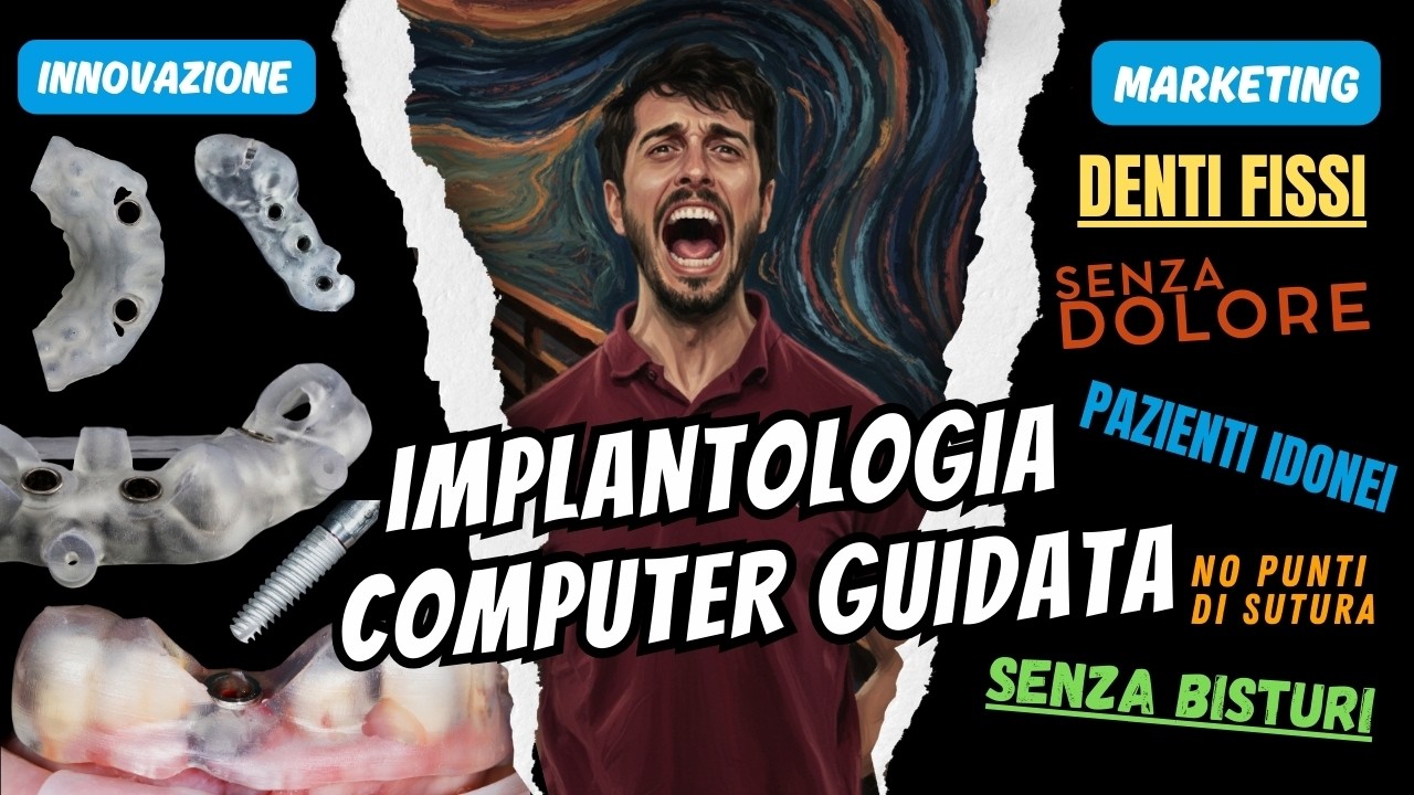 Implantologia guidata: quello che devi sapere sulla tecnica senza tagli e senza punti di sutura