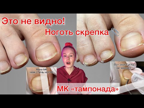 КАК ПРАВИЛЬНО СТРИЧЬ НОГТИ | НОГОТЬ-СКРЕПКА | ТАМПОНАДА ⚠️ подробно #алена_лаврентьева #nails #ногти