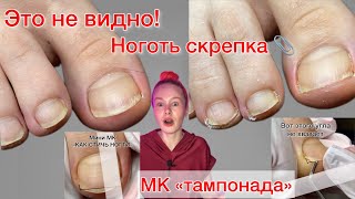 КАК ПРАВИЛЬНО СТРИЧЬ НОГТИ | НОГОТЬ-СКРЕПКА | ТАМПОНАДА ⚠️ подробно #алена_лаврентьева #nails #ногти