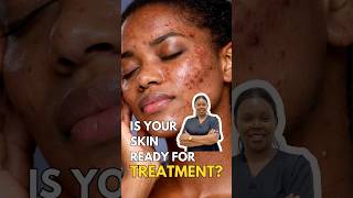 Signs Your Skin Isn’t Ready For Acne and Dark Spot Treatment | SKIN BARRIER EXPLAINED
