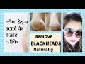 How to Remove Blackhead from Nose  | Remove Blackheads Naturally at Home | JSuper Kaur