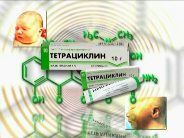 Профилактика конъюнктивита. Обработка глаза новорожденного