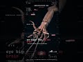 Giant Squid — EYE: Eye bigger than its own brain | Benthos Error