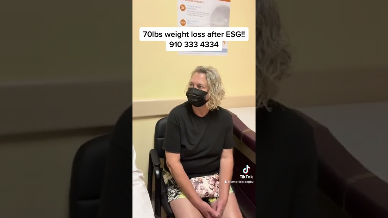 Non surgical weight loss with ESG