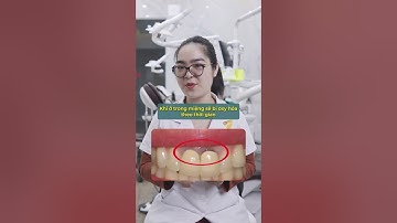 #120   Bọc răng sứ bị đen viền lợi giải quyết như thế nào? | Nha Khoa Lê Đông #shorts