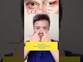 One move to improve tear troughs and eye bags!