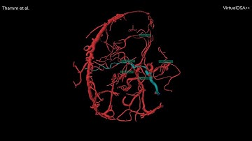 (PART 1) VirtualDSA++: Segmentation, Modelling and Interaction with the Cerebrovascular Vessel Tree