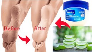 DIY Foot and Hand Cream