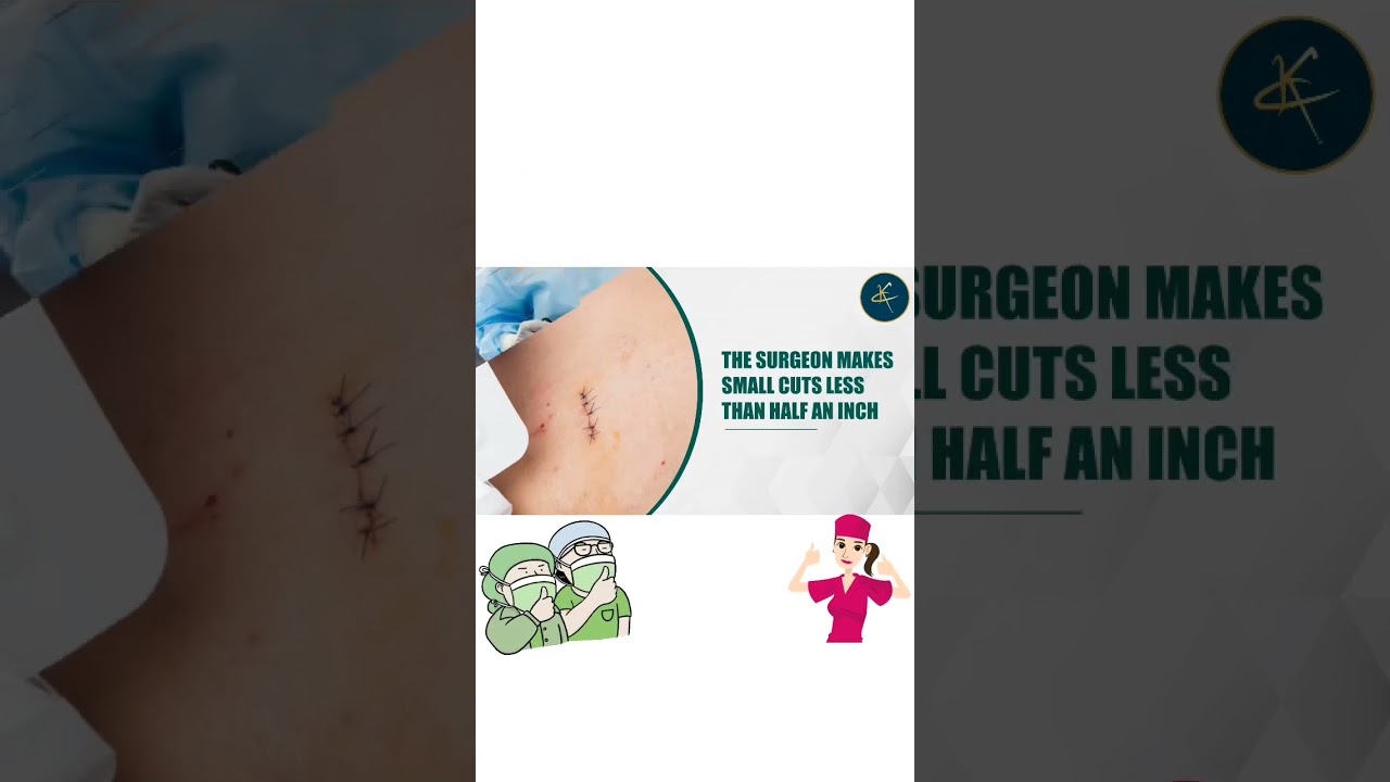 Laparoscopic Urology Surgeries/ keyhole Urology surgeries includes & benefits dr ankit kayal