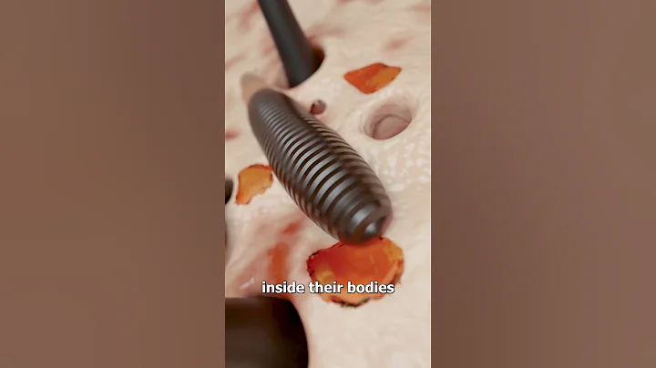 Tiny Bugs Poop Inside Your Face 😱